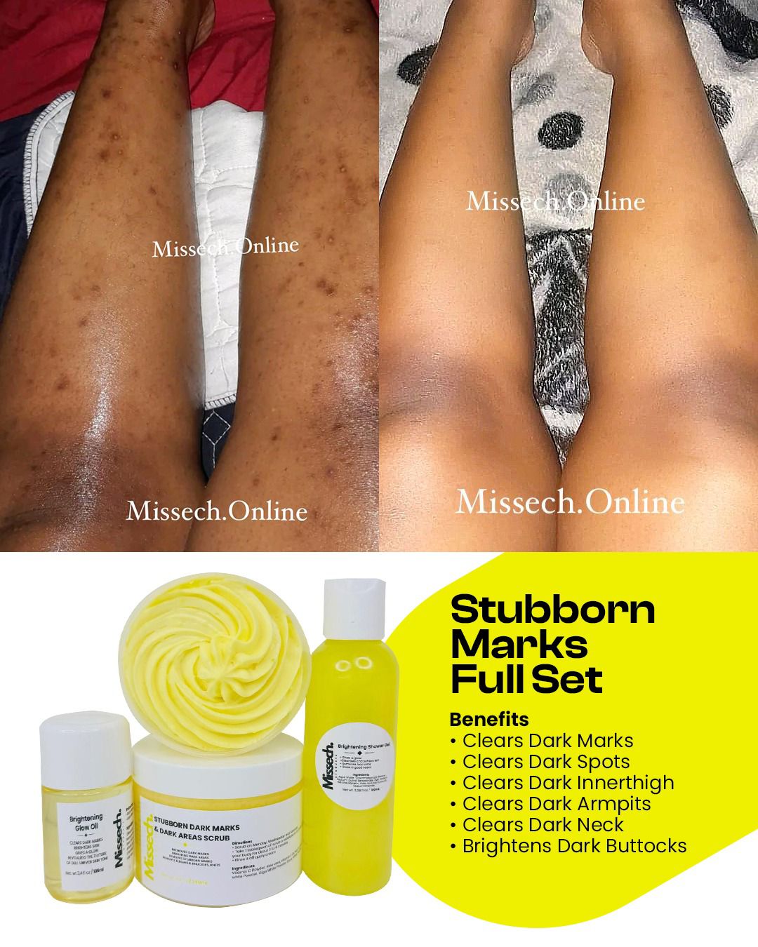 Stubborn Marks & Stubborn Dark Areas Full Set