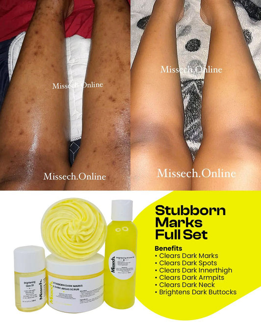 Stubborn Marks & Stubborn Dark Areas Full Set